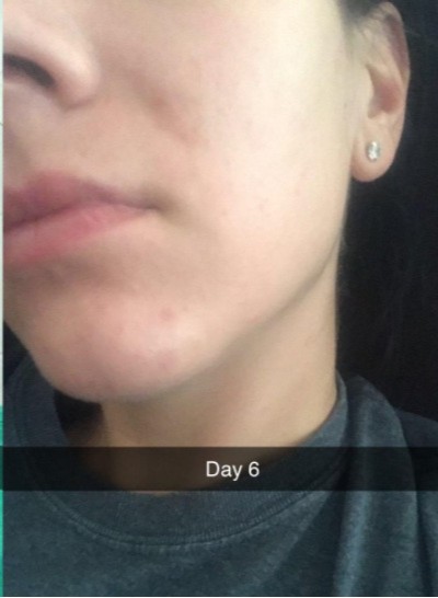 After — Customer results — smoother, brighter skin after YEOUTH Retinol routine